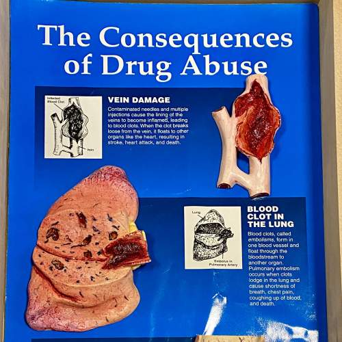 Cased Drug Abuse Educational Diorama image-2